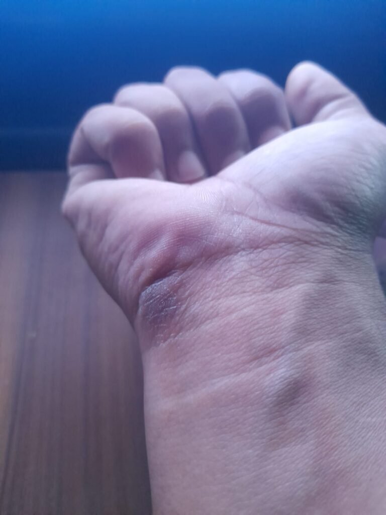 The Gamer’s Mark: Solving Hand Irritation from Extended Mouse Use
