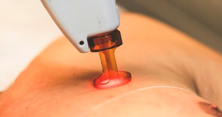 The Ultimate Guide to Facial Pore Blackhead Remover Vacuum: Your Go-To Face Cleaner